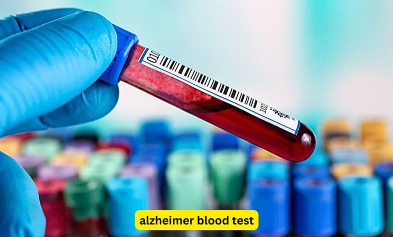 Alzheimer's blood test