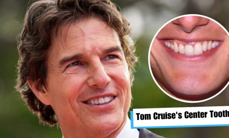 Tom Cruise's Center Tooth