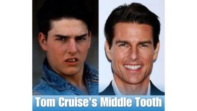 Tom Cruise's Middle Tooth