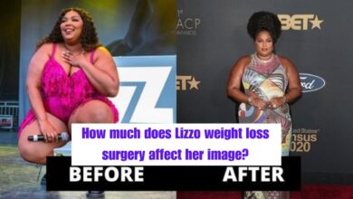 How much does Lizzo weight loss surgery affect her image?